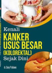 Kenali kanker usus besar (kolorektal)