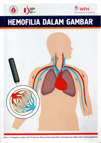 Hemofilia dalam gambar