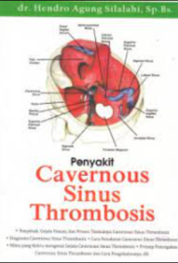 Penyakit cavernous sinus thrombhosis