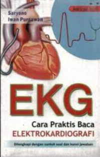 Cara praktis baca elektrokardiografi (ekg)