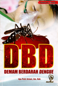 Demam berdarah dengue (dbd)