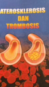 Aterosklerosis dan trombosis