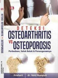 Deteksi osteooarthritis vs osteoporosis: perbedaan, seluk beluk dan penangannya